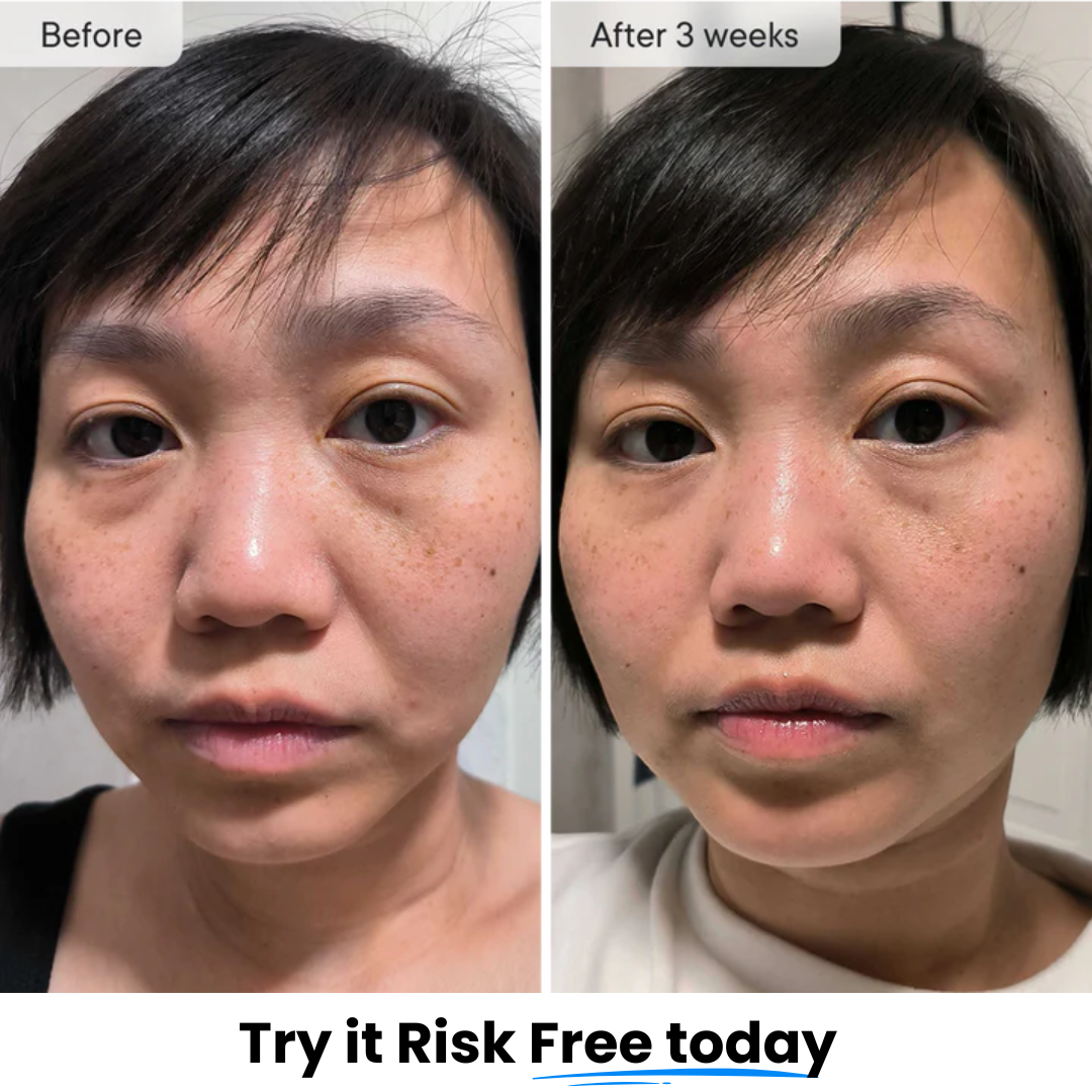 Smooth, firm and plump stubborn areas with Micro-Infusion Targeted Patches