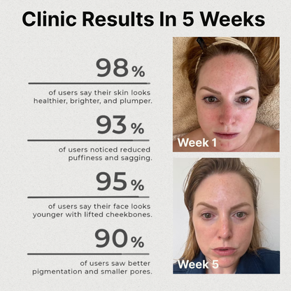 Facial Cupping Therapy Kit | By Diare