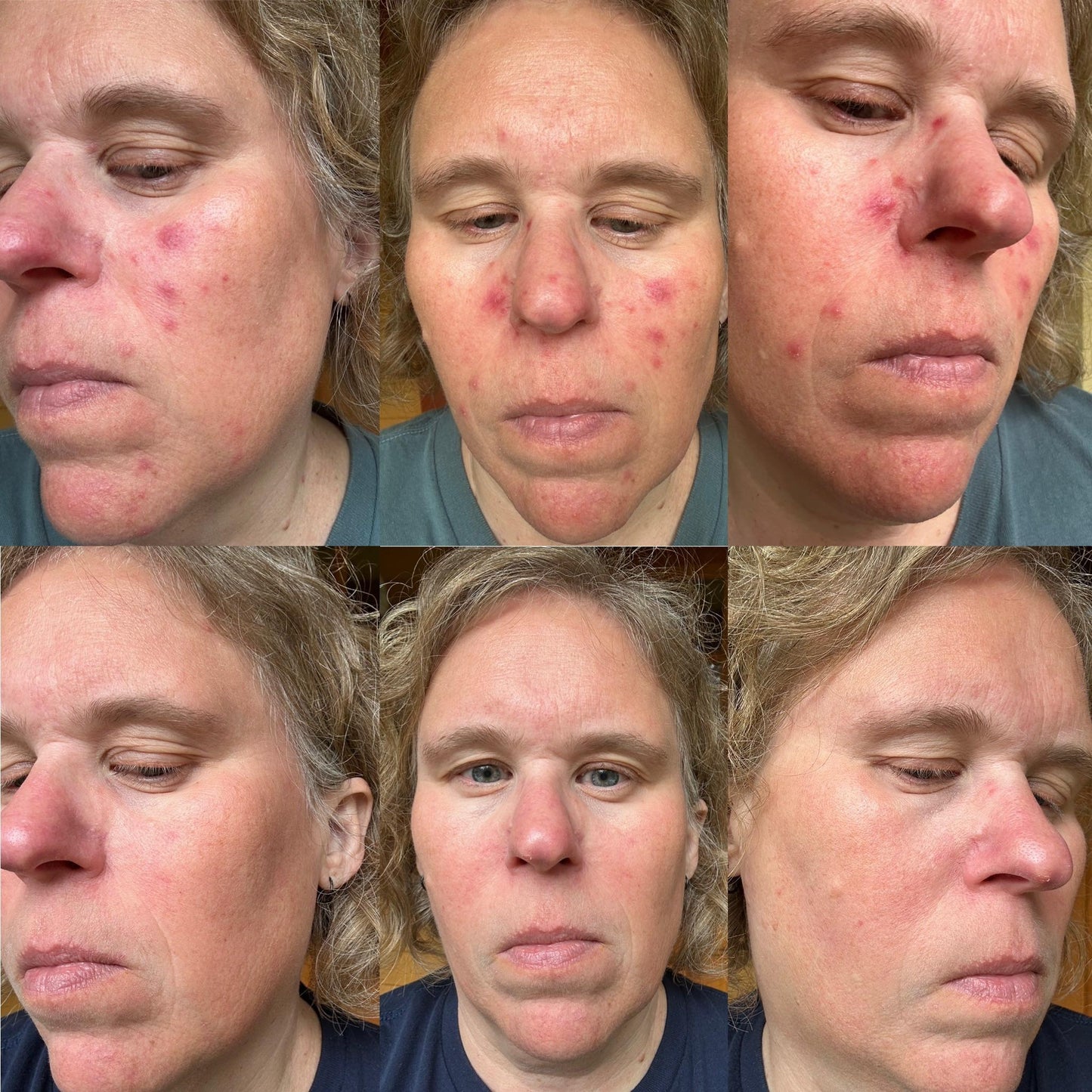 Soothe redness and hydrate deeply - 3H Relief Cream