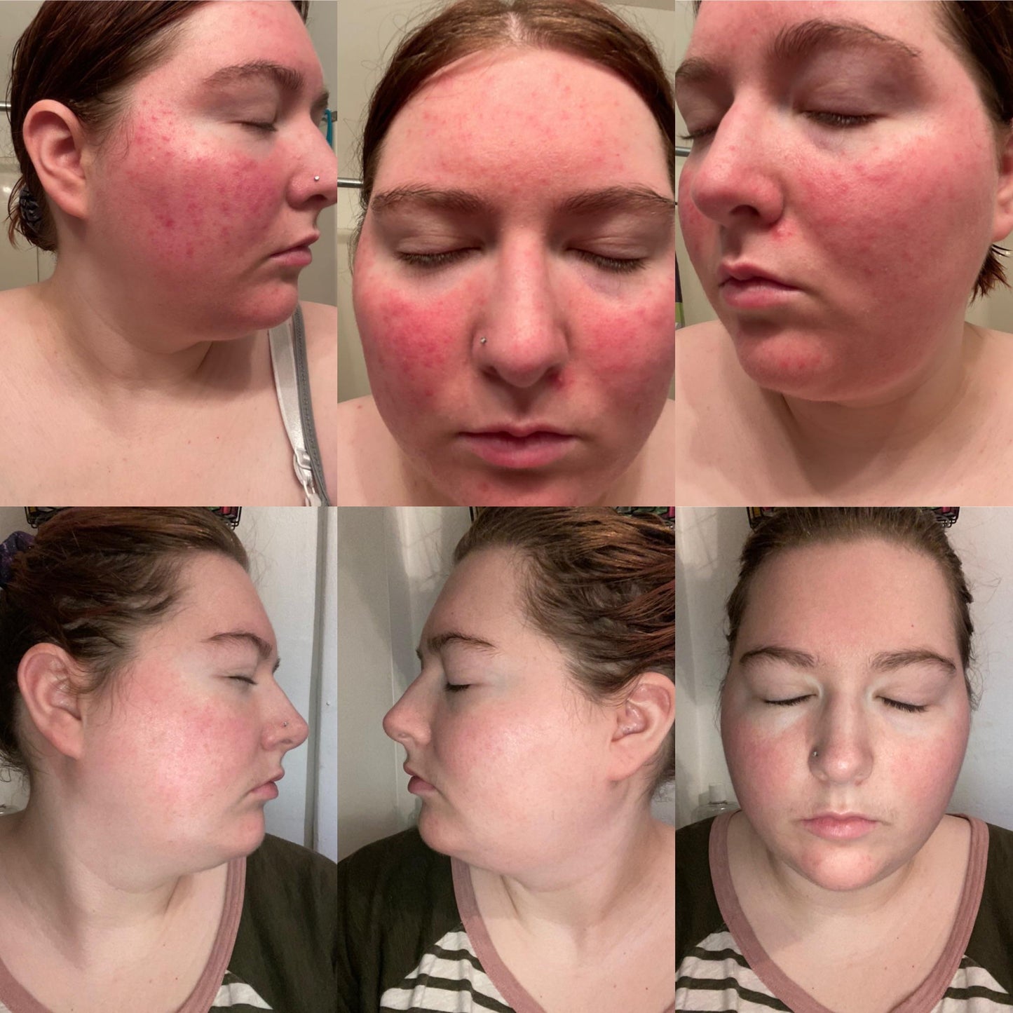 Soothe redness and hydrate deeply - 3H Relief Cream